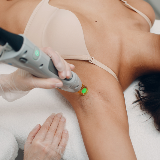 laser hair removal